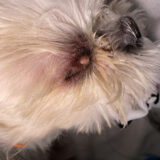 眼瞼腫瘍摘出術 まぶたの腫瘍 マイボーム腺腫