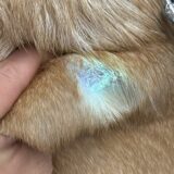 皮膚糸状菌　皮膚のカビの感染