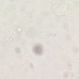 犬　猫の寄生虫　トリコモナス下痢