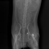 犬の股関節脱臼　骨頭靭帯再建術