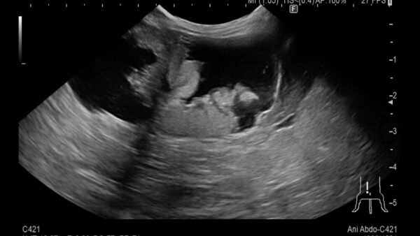 メスうさぎの避妊手術　子宮腺癌　がん