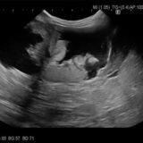 メスうさぎの避妊手術　子宮腺癌　がん