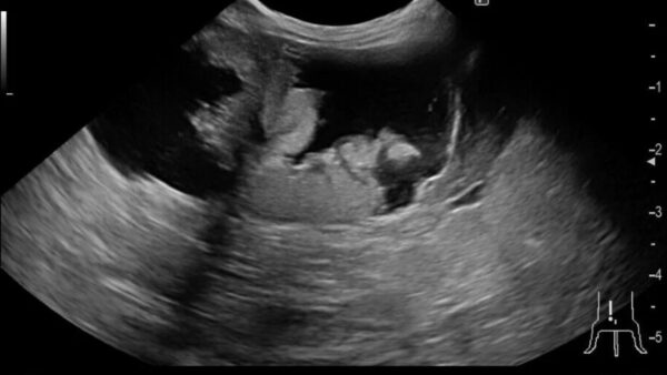 メスうさぎの避妊手術　子宮腺癌　がん