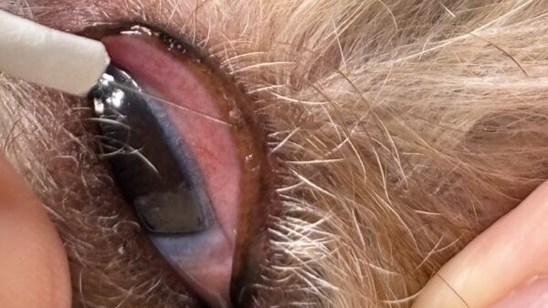 逆さまつげ　異所性睫毛　電気針脱毛