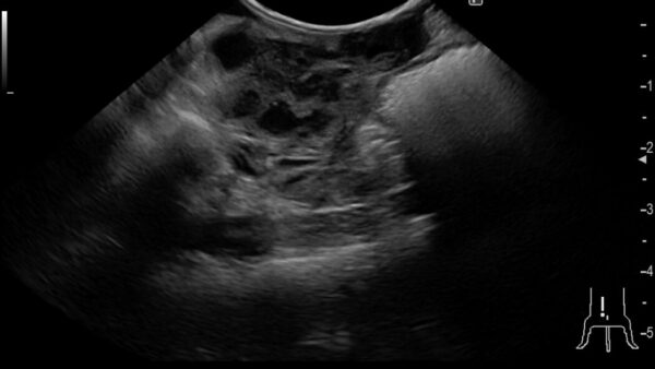 超小型犬　ティーカッププードル　子宮蓄膿症　腹膜炎