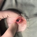 チェリーアイ　瞬膜腺脱出　手術
