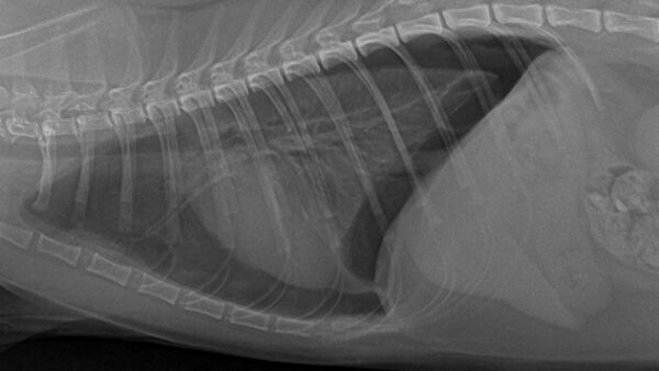高所墜落による高エネルギー外傷 気胸 骨折 手術(７階から落ちた猫)