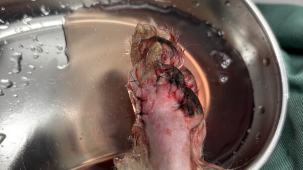 指を残して腫瘍摘出手術　指の腫瘍　指切断