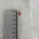 ミニチュアダックス　椎間板ヘルニア　手術　歩けるまでの経過