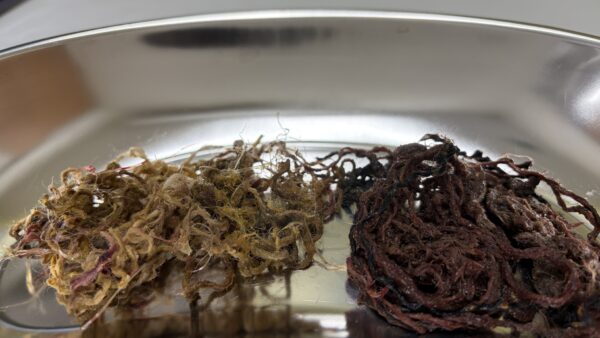 消化管内異物　ひも状異物　摘出